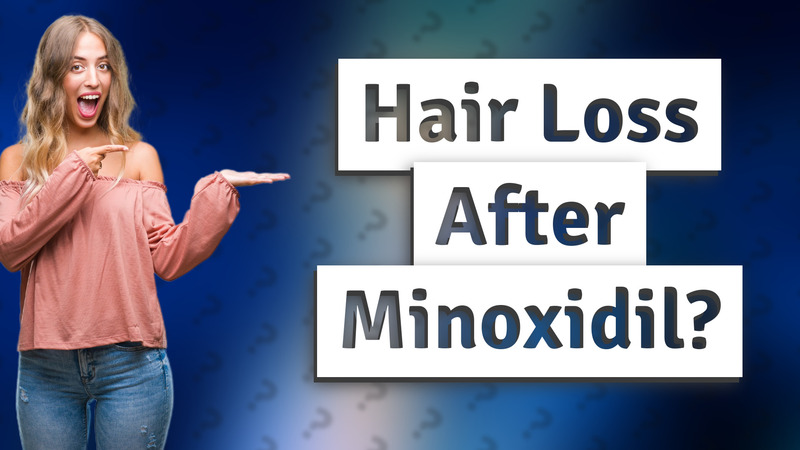 Hair Loss After Minoxidil?