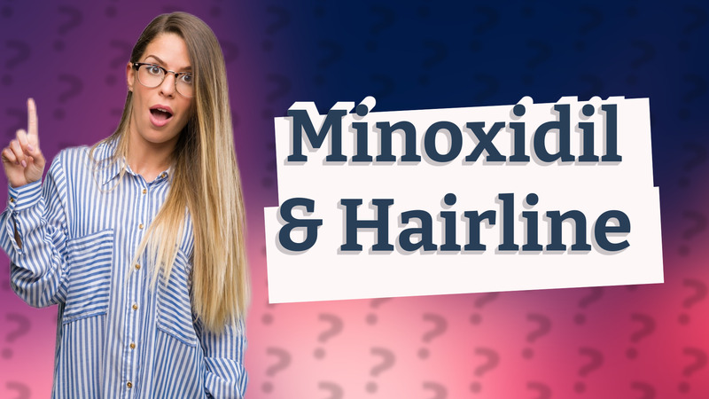Minoxidil & Hairline