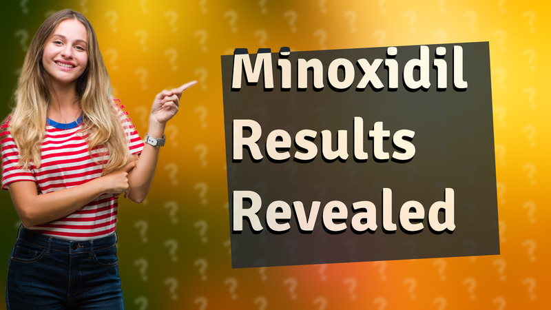Minoxidil Results Revealed