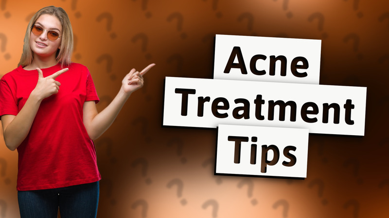 Acne Treatment Tips