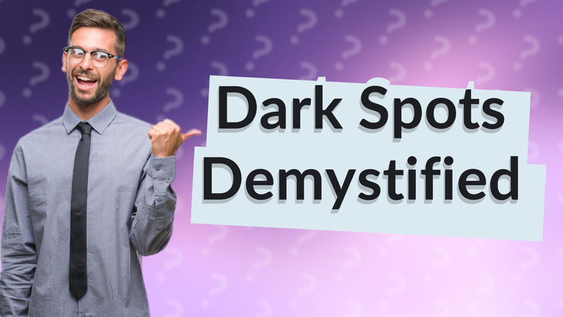 Dark Spots Demystified