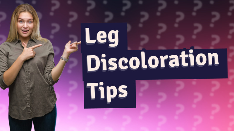 Leg Discoloration Tips