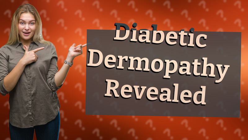Diabetic Dermopathy Revealed