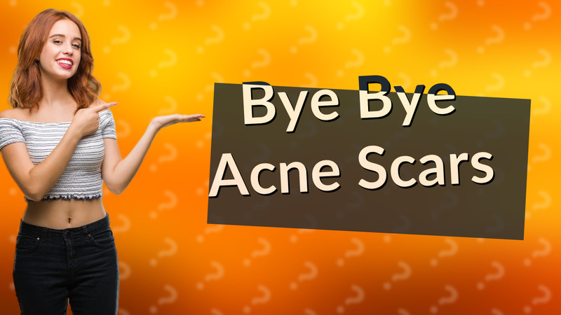 Bye Bye Acne Scars