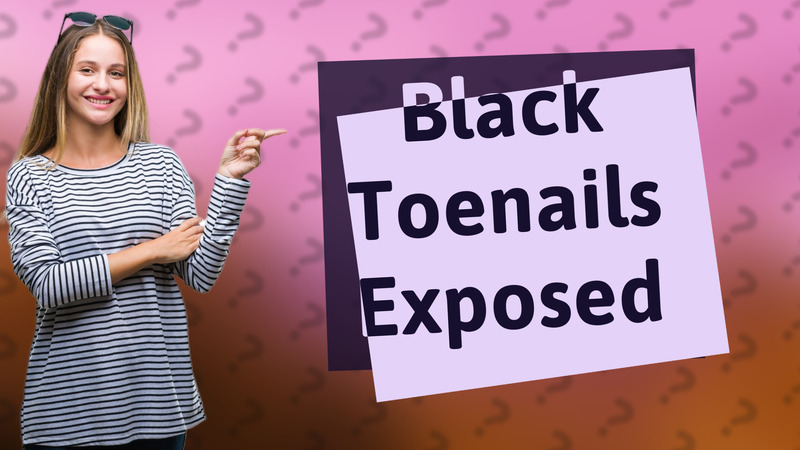Black Toenails Exposed