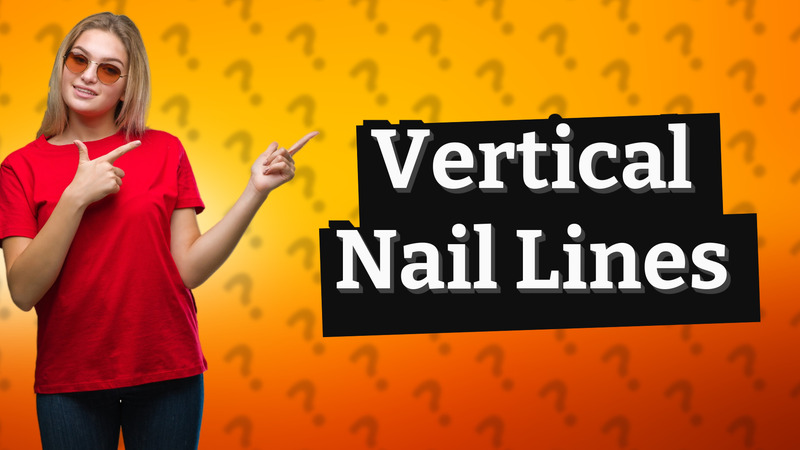 Vertical Nail Lines