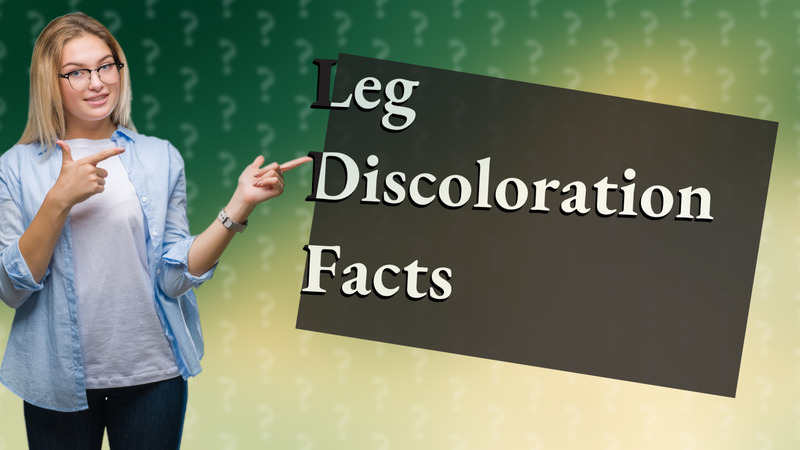 Leg Discoloration Facts