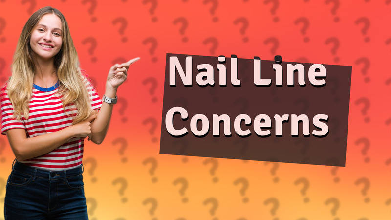 Nail Line Concerns