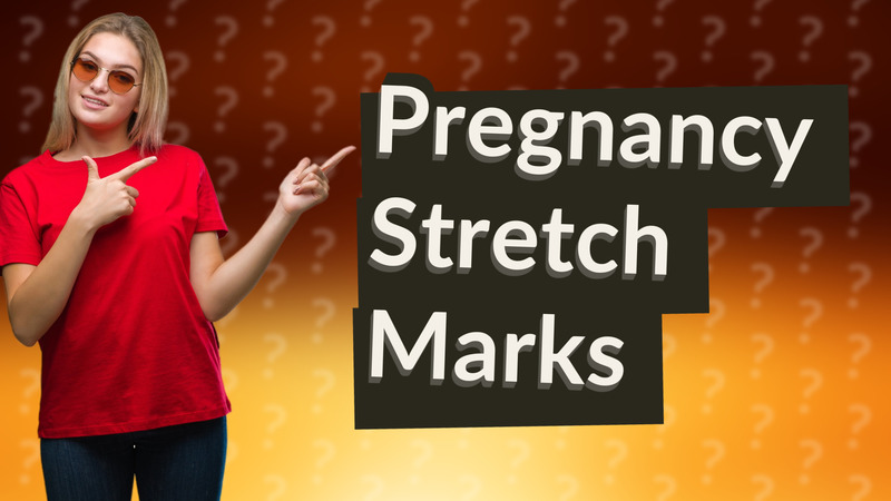 Pregnancy Stretch Marks