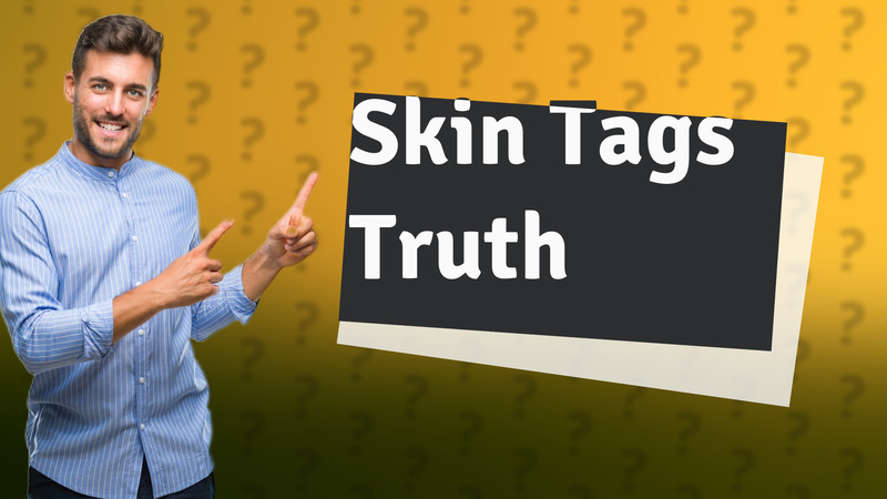 Skin Tags Truth