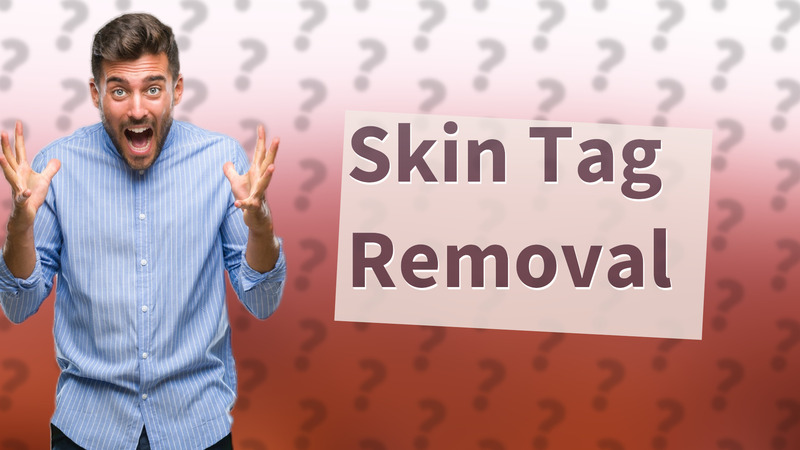 Skin Tag Removal