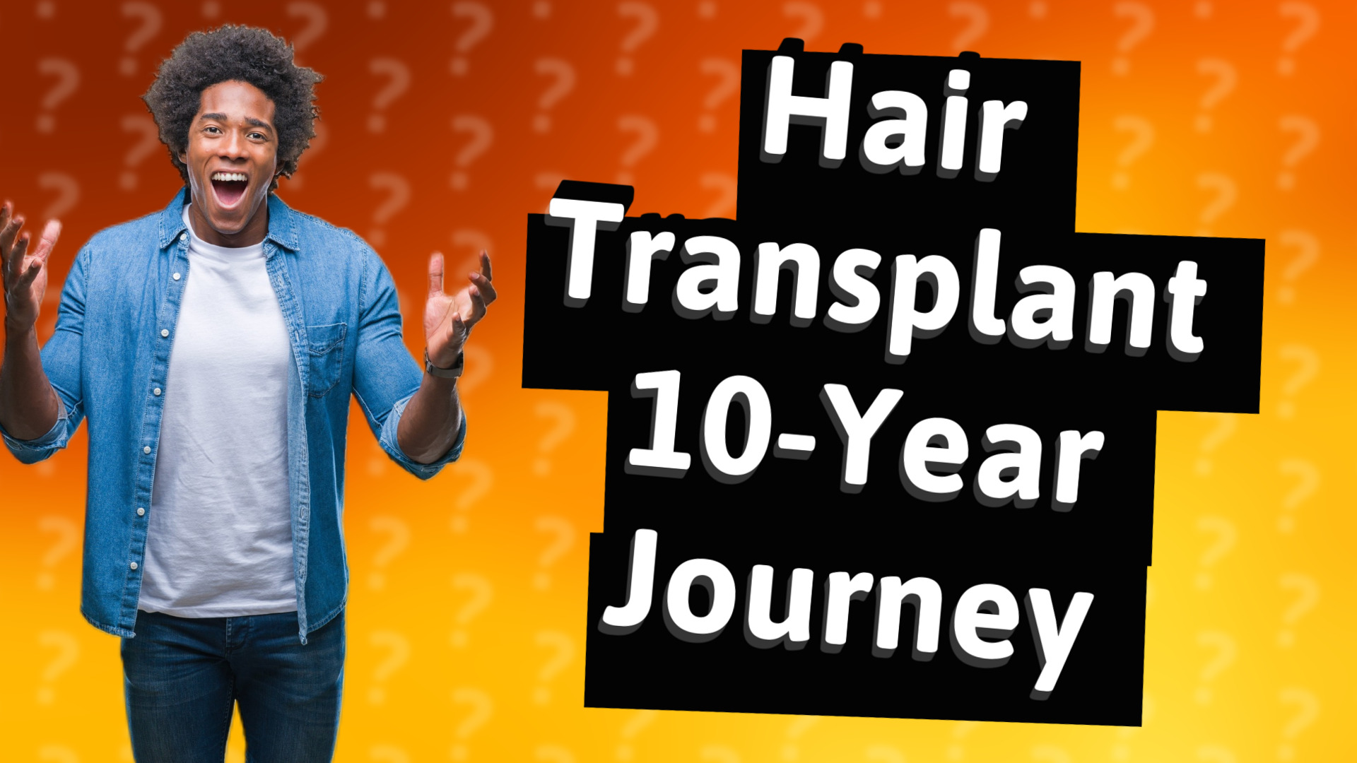 Hair Transplant 10-Year Journey