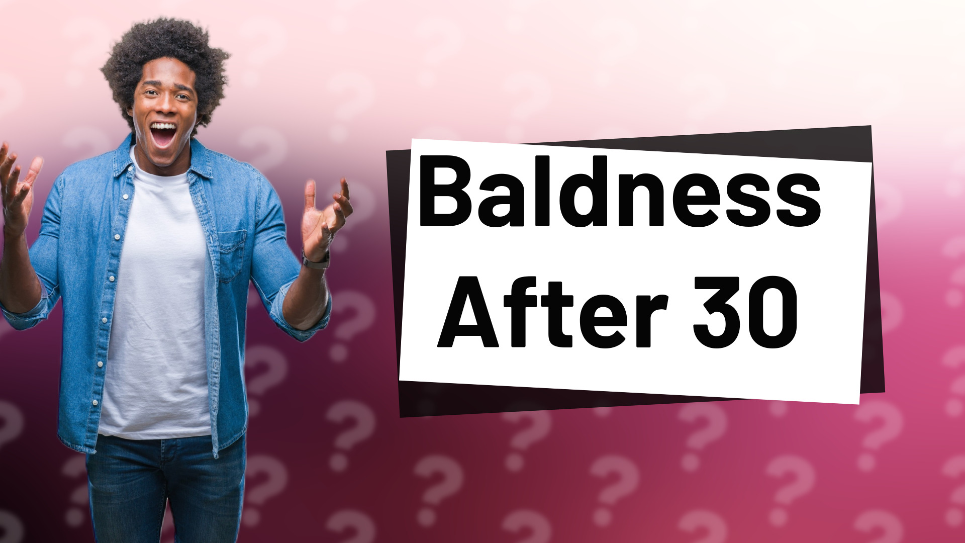 Baldness After 30