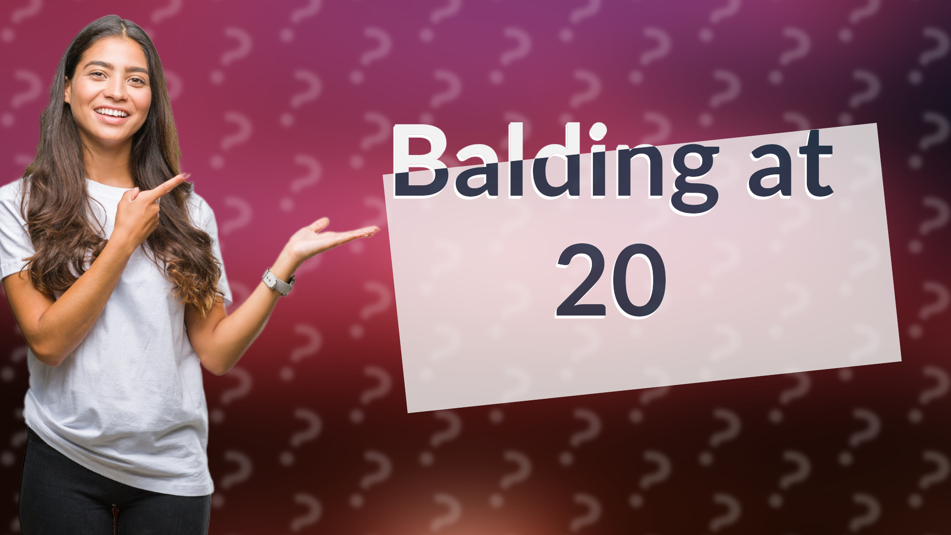 Balding at 20